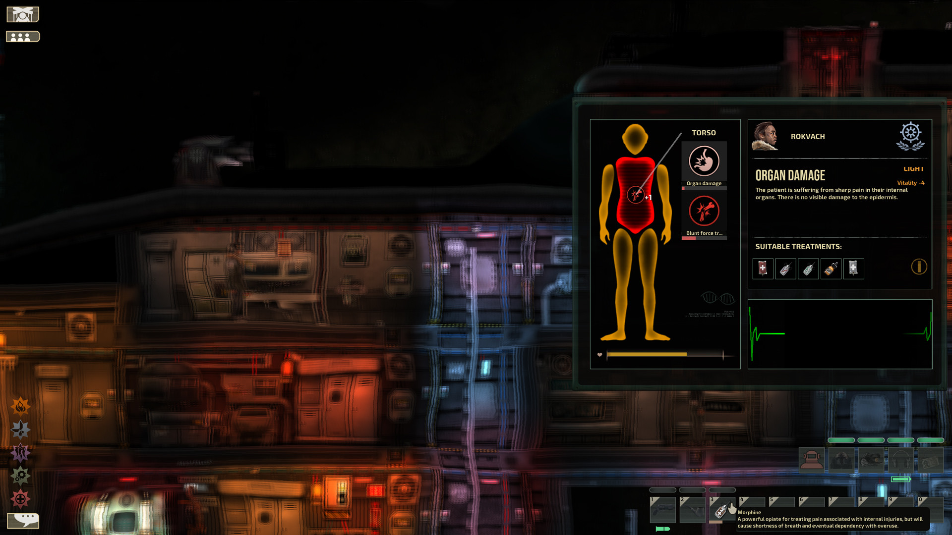 潜渊症 Barotrauma_1